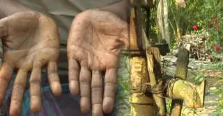 সাতক্ষীরায় আর্সেনিকের ভয়াবহ থাবা; আক্রান্ত প্রায় প্রতিটি পরিবার