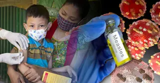 হামের টিকা কত মাস বয়সে দিতে হয়