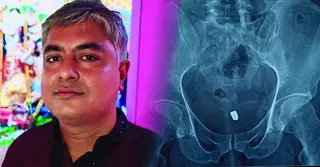 মিরসরাইয়ে যুবলীগের সাবেক সাধারণ সম্পাদকের ওপর দুর্বৃত্তের হামলা-গুলি