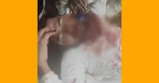 ঢাকা মেডিকেলে নেয়া হয়েছে আহত নুরকে