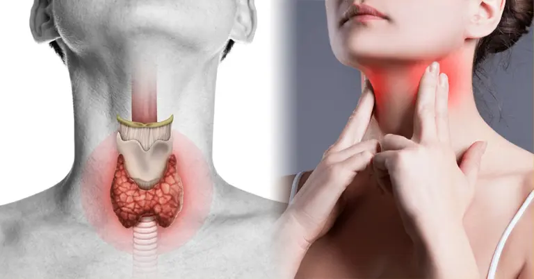 থাইরয়েডের সমস্যা