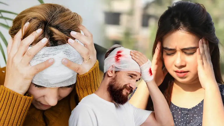 সাবডিউরাল হেমাটোমা