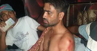 বিএসএফের গুলিতে বাংলাদেশি যুবক আহত
