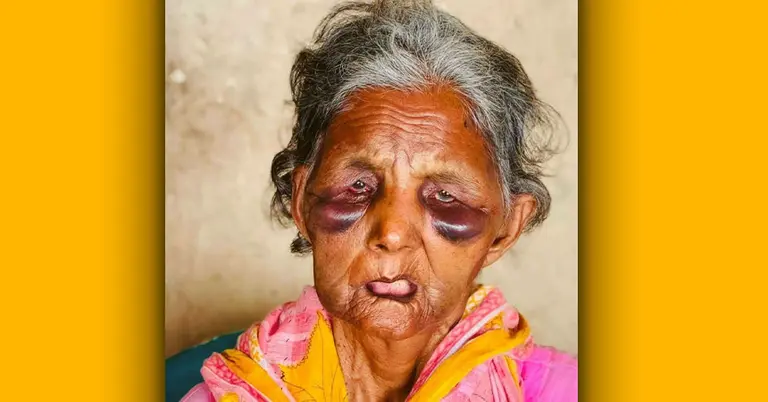 নিহত বাকপ্রতিবন্ধী বুবি