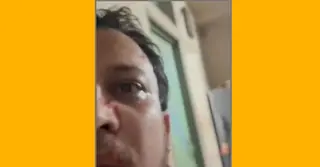 চাঁদা না পেয়ে চিকিৎসকের ওপর হামলা; ফেসবুক লাইভে সাহায্যের আবেদন