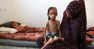 গাজায় অনাহারে একদিনেই নিহত ১০ শিশু, দুর্ভিক্ষ ছড়ানোর শঙ্কা জাতিসংঘের
