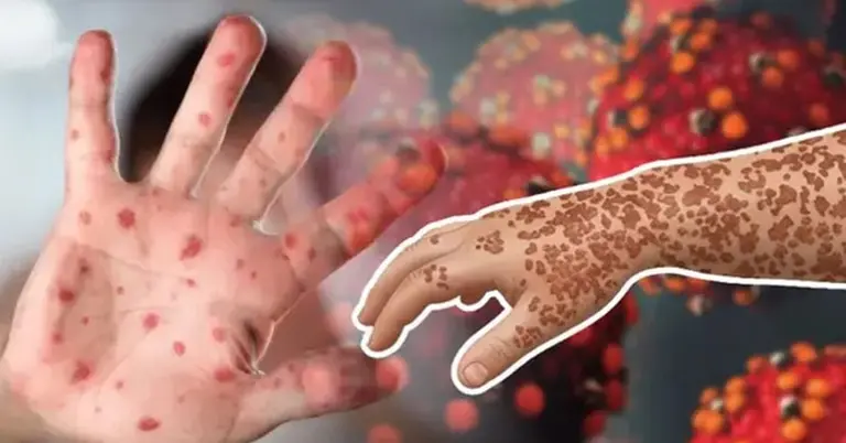 প্রতীকী ছবি