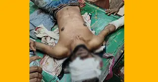 শরীয়তপুরে অটোচালকের ওপর নৃশংস হামলা-কুপিয়ে জখম, আটক ২