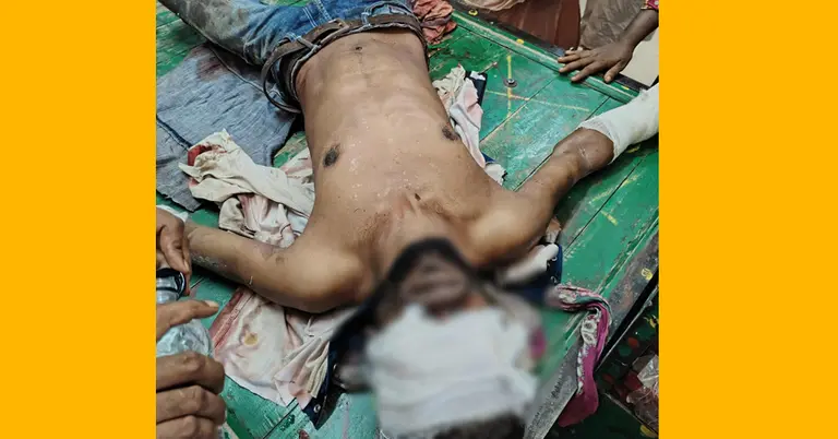 আহত রমজান মোল্লা